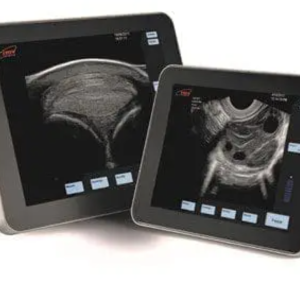 Máy siêu âm mini ExaPad